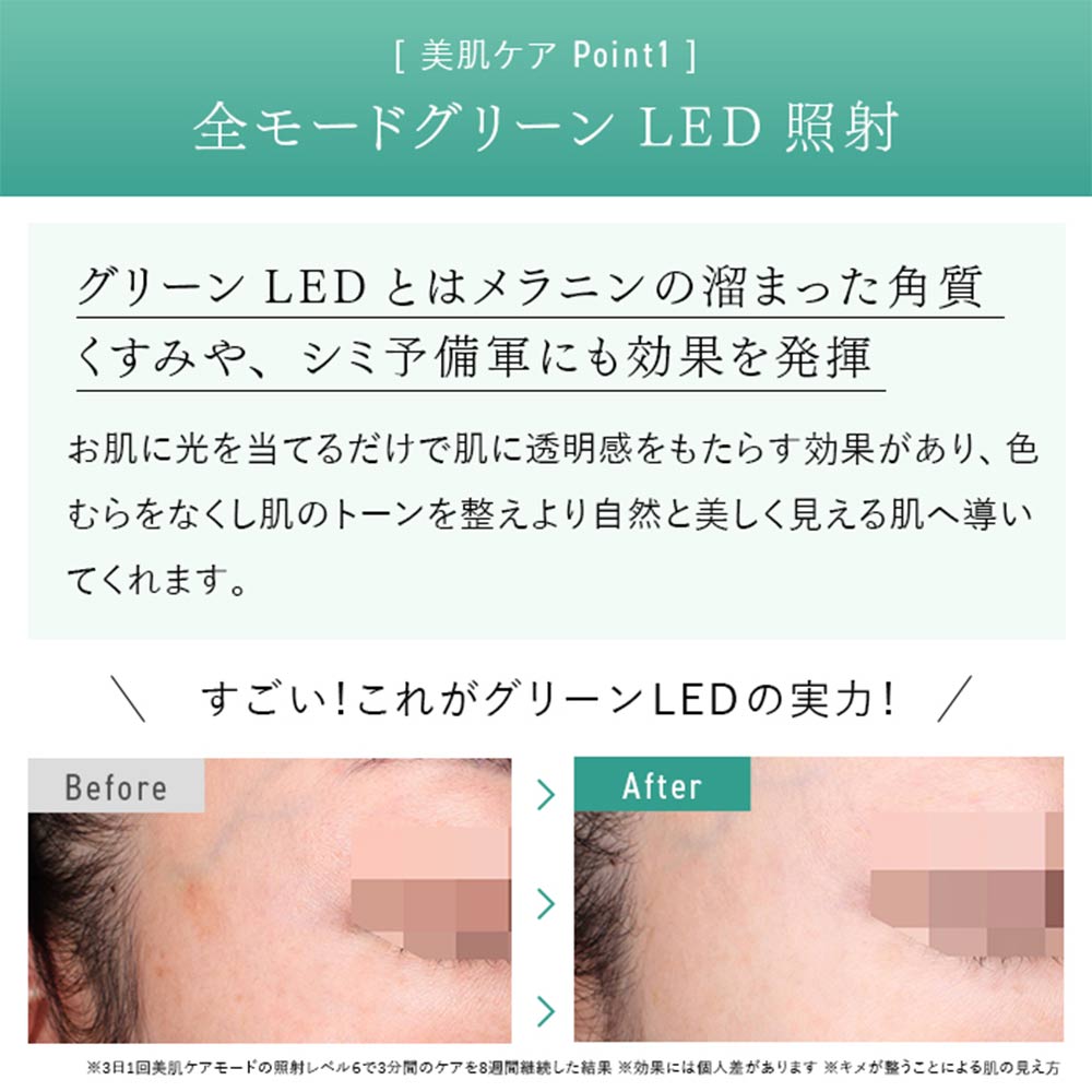 STELLA BEAUTE IPL&amp;LED光美容器 SB-IFD03 / STELLA BEAUTE（ステラ ボーテ） / その他美容家電 / STB10001_dt_07.jpg