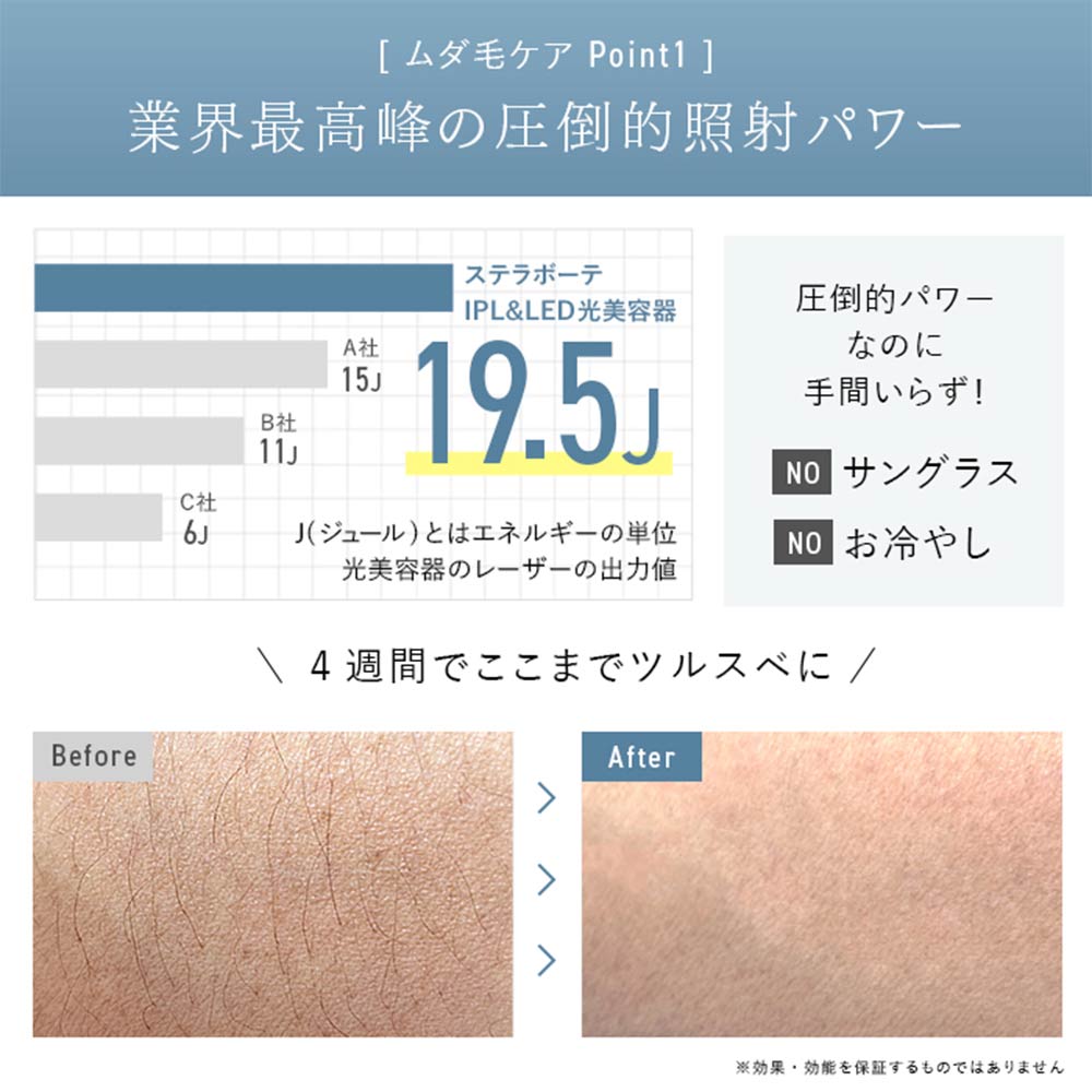STELLA BEAUTE IPL&amp;LED光美容器 SB-IFD03 / STELLA BEAUTE（ステラ ボーテ） / その他美容家電 / STB10001_dt_13.jpg
