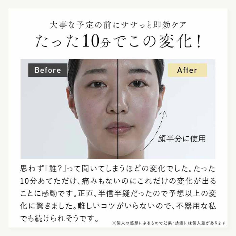 STELLA BEAUTE Beauty Face Stick2.0 SB-BFS02 / STELLA BEAUTE（ステラ ボーテ） / 美顔器・美顔ローラー / STB10002_dt_06.jpg